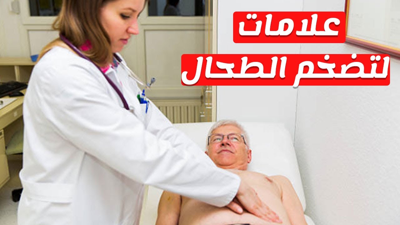 تضخم الطحال - ماذا يعني بتضخم الطحال 1608