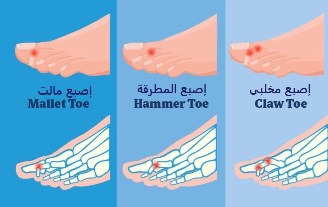 معلومات عن الجسد - اسماء اصابع القدم 12626 4