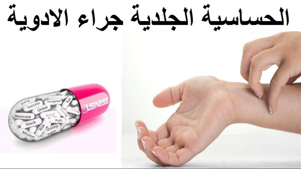 اعراض حساسية الانف , اسباب حساسية الانف