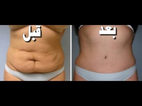 كيف تتخلص من الكرش - طريقة سهلة للتخلص من الكرش نهائيا 2722 2