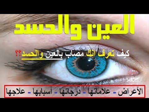 ازاي تعرف نفسك محسود - علامات المصاب بالعين 12604 6