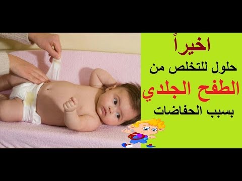 علاج تسلخات الاطفال بالاعشاب - طفلى يعانى من التسلخات ما الحل 13170 2