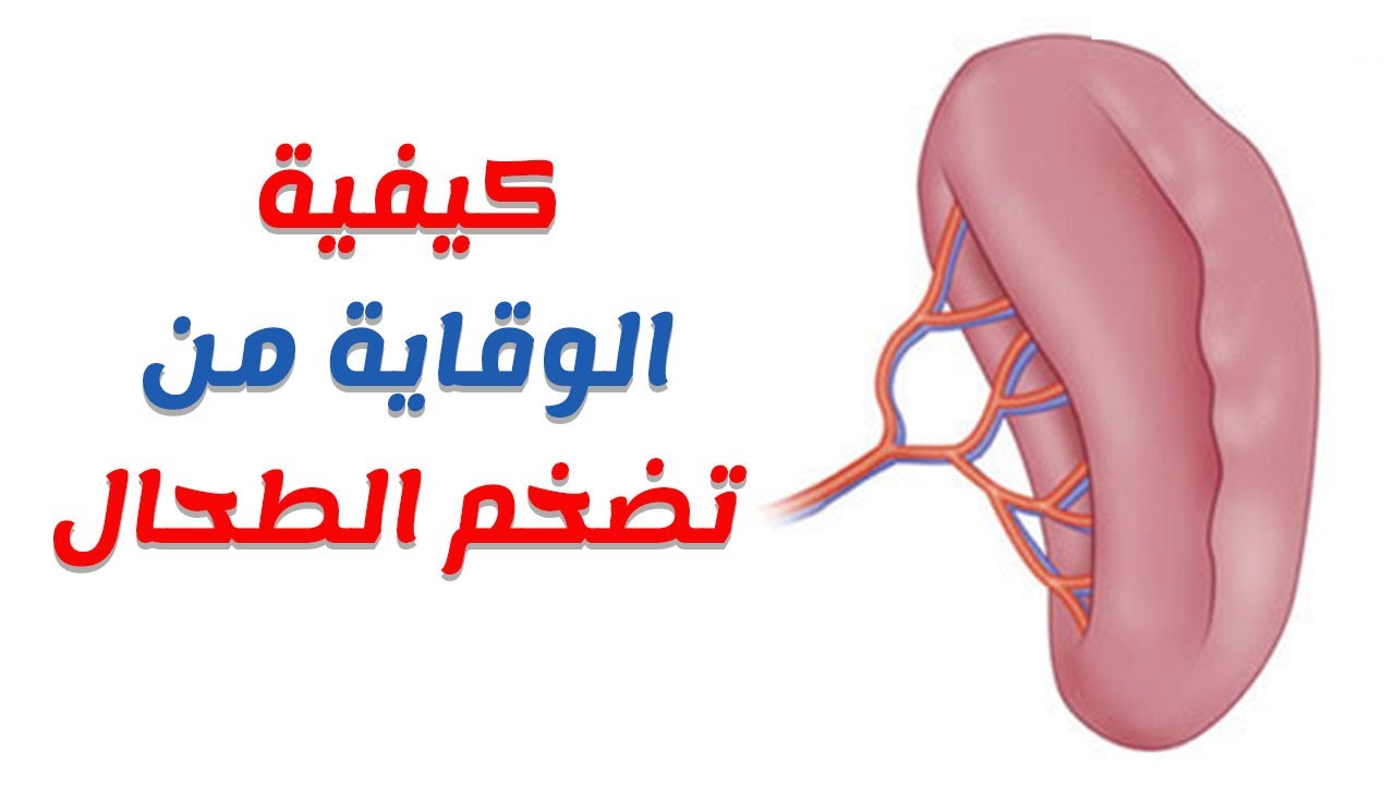 تضخم الطحال - ماذا يعني بتضخم الطحال 1608 1