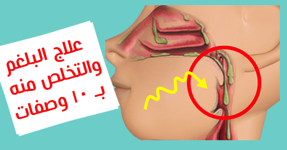 التخلص من البلغم - كيفية طرد البلغم 2113