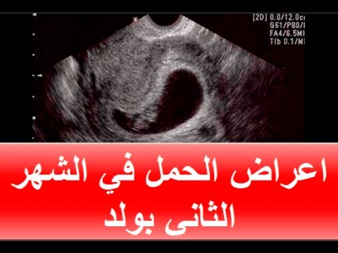 علامات الحمل بولد في الشهر الثاني , ماهي علامات الحمل