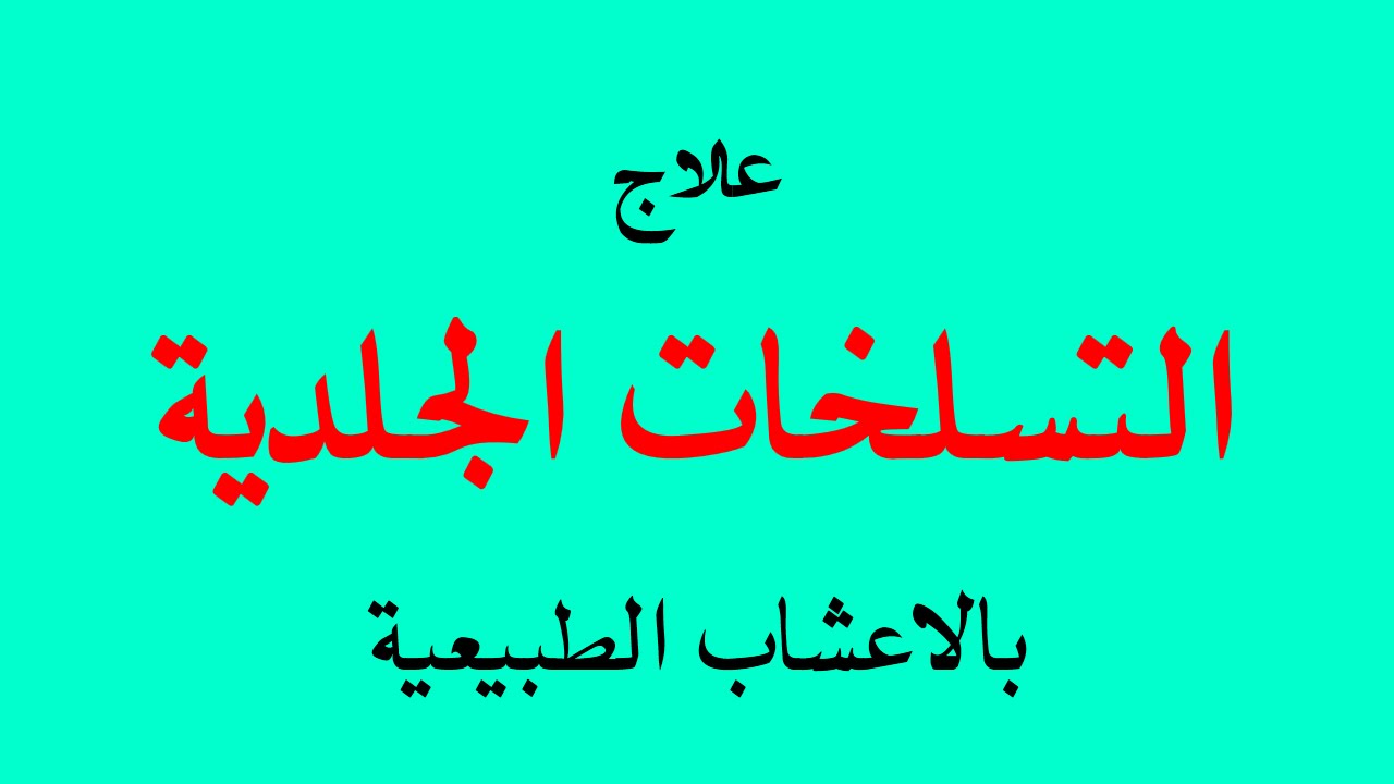 علاج تسلخات الاطفال بالاعشاب - طفلى يعانى من التسلخات ما الحل 13170 3