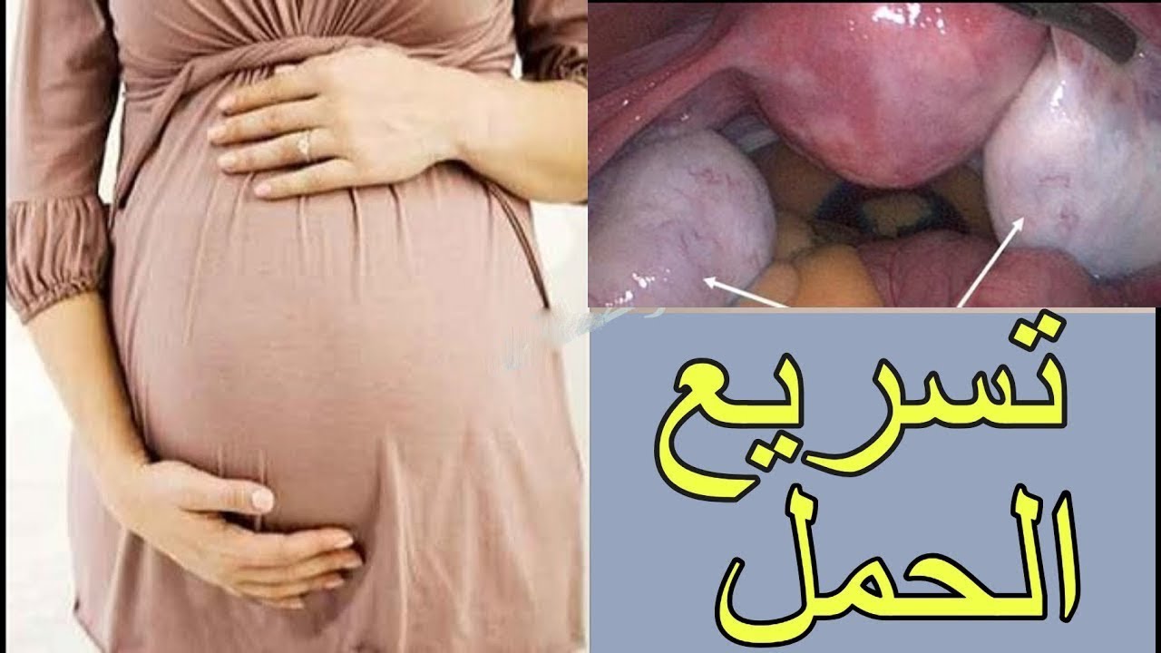 الحل النهائى لمشكله التكيس - علاج التكيس 4106 1