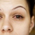6122 3 علاج حساسية العين - علاجات العين واسباب حساسيتها حلاوة الوقت