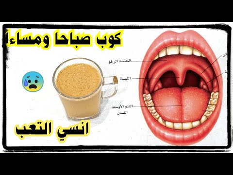 عادات خاطئة - علاج التهاب الحلق 895 1